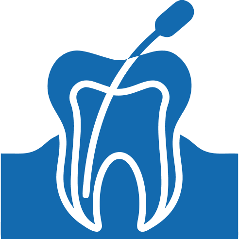 Endodontics (Root Canal Treatments) treatment in banglore