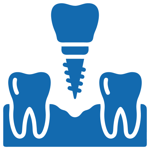 Best implant dentry in banglore