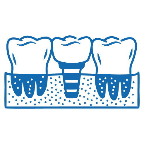 Best Prosthodontics in banglore