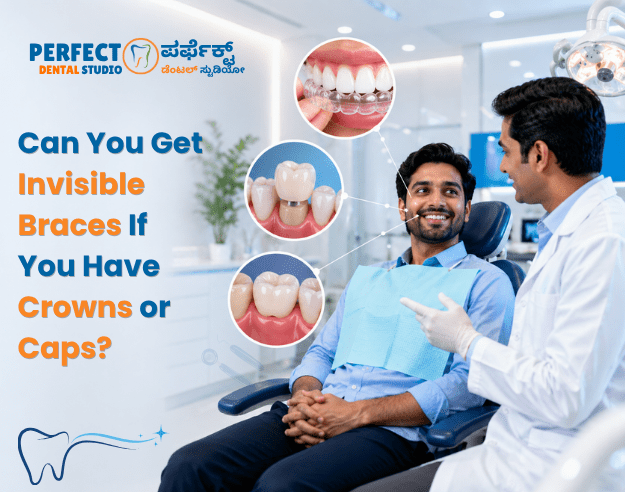 teeth aligners,with best dentall care in perfect dental studio